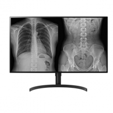 Zdravotnická diagnostická obrazovka LG