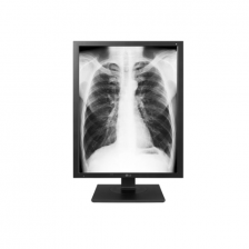 Zdravotnícky 21,3 "farebný diagnostický monitor IPS s vysokým jasom